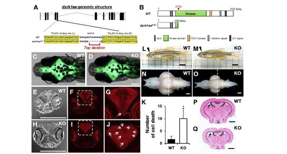 https://www.ncbi.nlm.nih.gov/pubmed/?term=Zebrafish+knockout+of+Down+syndrome+gene%2C+DYRK1A%2C+shows+social+impairments+relevant+to+autism