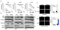 https://www.ncbi.nlm.nih.gov/pubmed/?term=DDIAS+suppresses+TRAIL-mediated+apoptosis+in+cancer+cells+by+inhibiting+DISC+formation+and+destabilizing+caspase-8