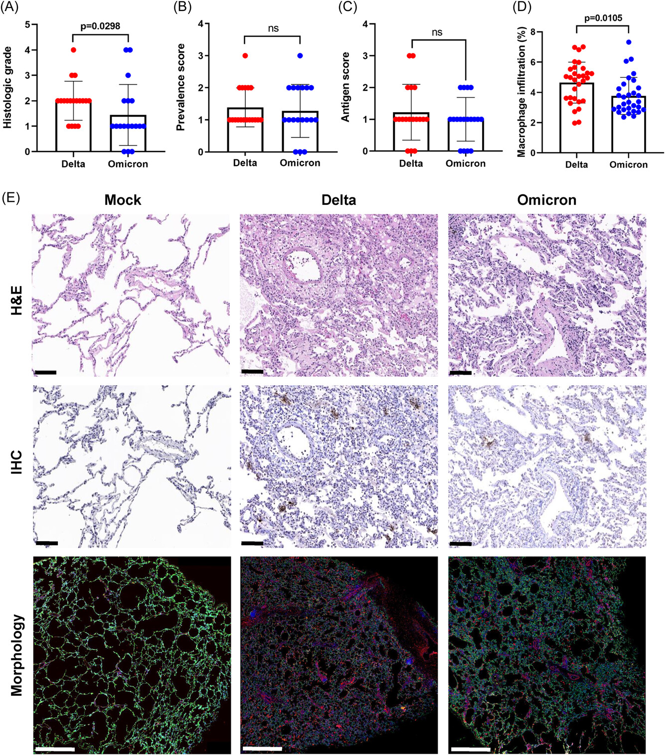 Comparative spatial transcriptomic profiling of severe acute respiratory syndrome coronavirus 2 Delt